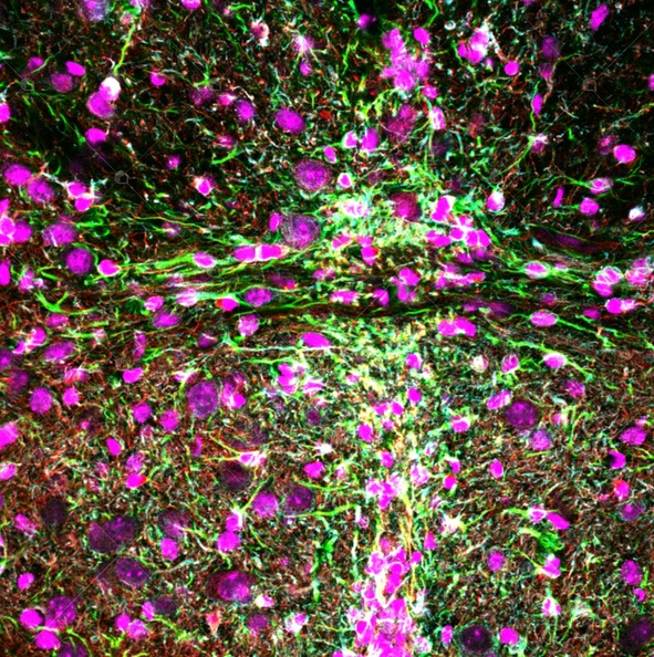 stem cells in spinal niches.jpg