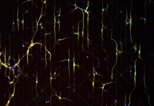Neuronal stripes