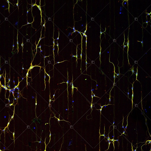 pattern neuroni su PLL.jpg