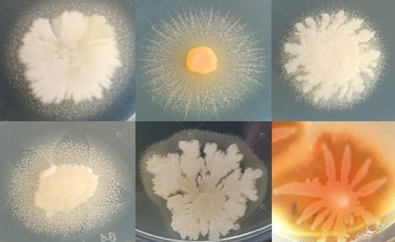 Morphology of bacterial colonies.jpg